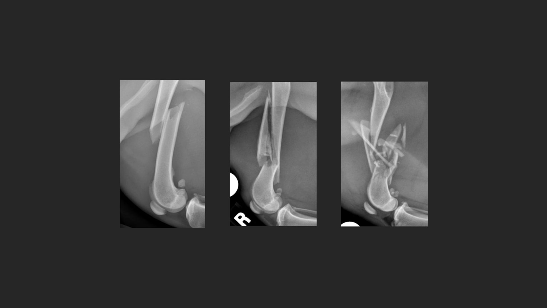 How to Describe a Fracture and Why It Matters