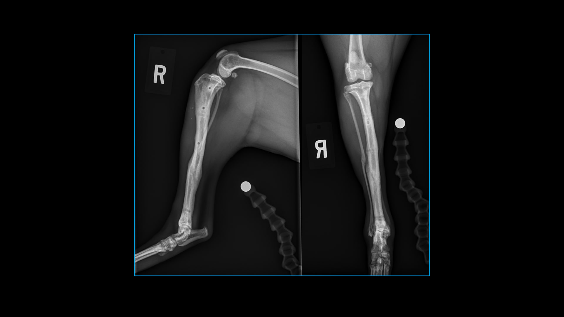 Post-op Assessments: The 4 A’s