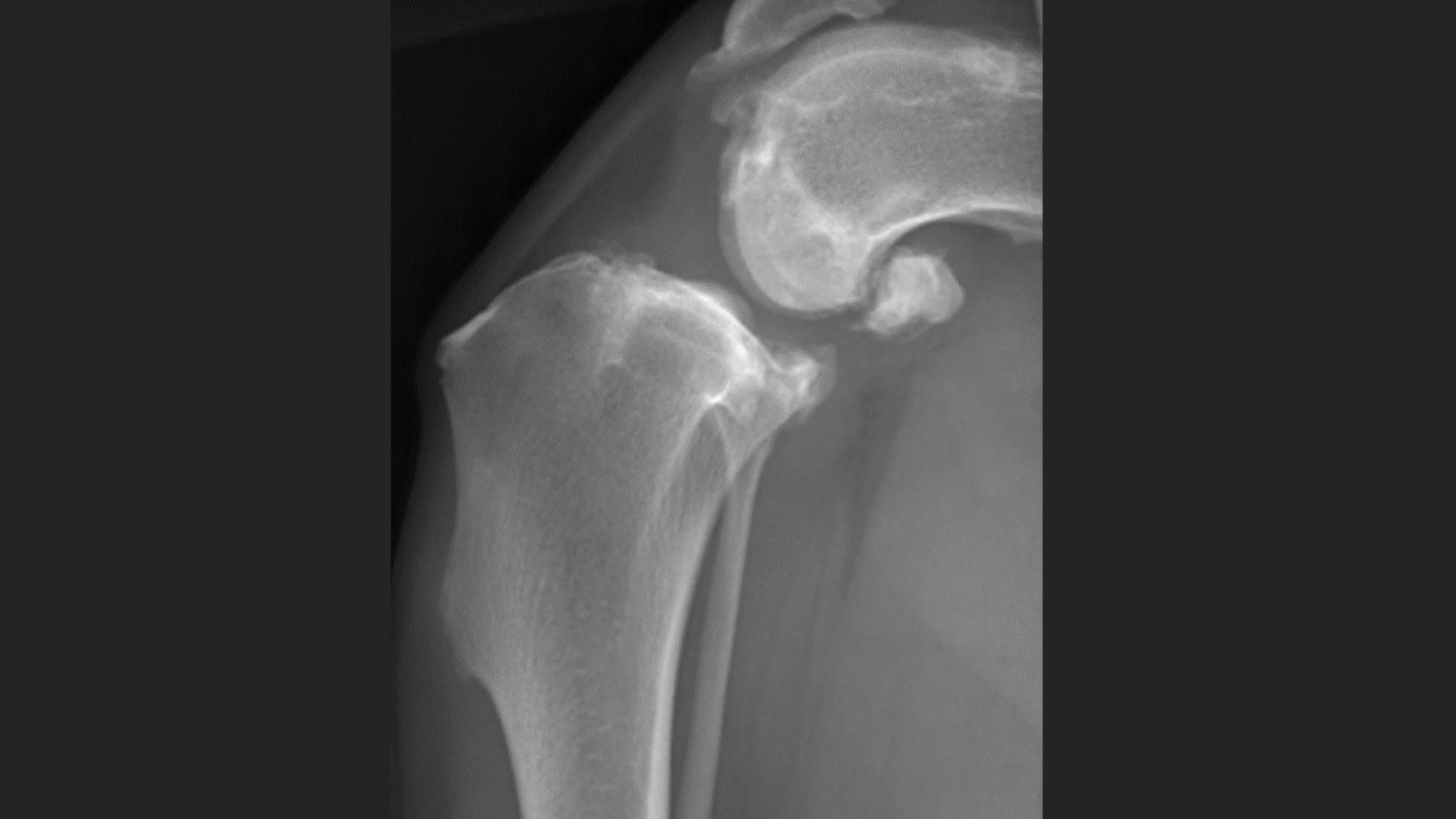 Arthrex - Stifle Joint: Effective Evaluation From Physical Exam to ...