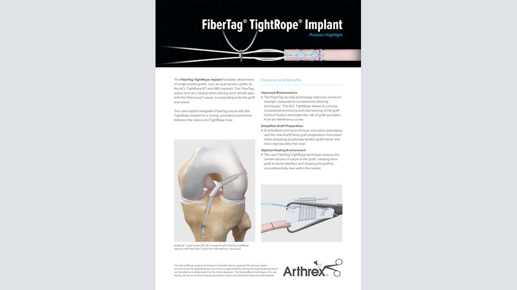 FiberTag® TightRope® Implant