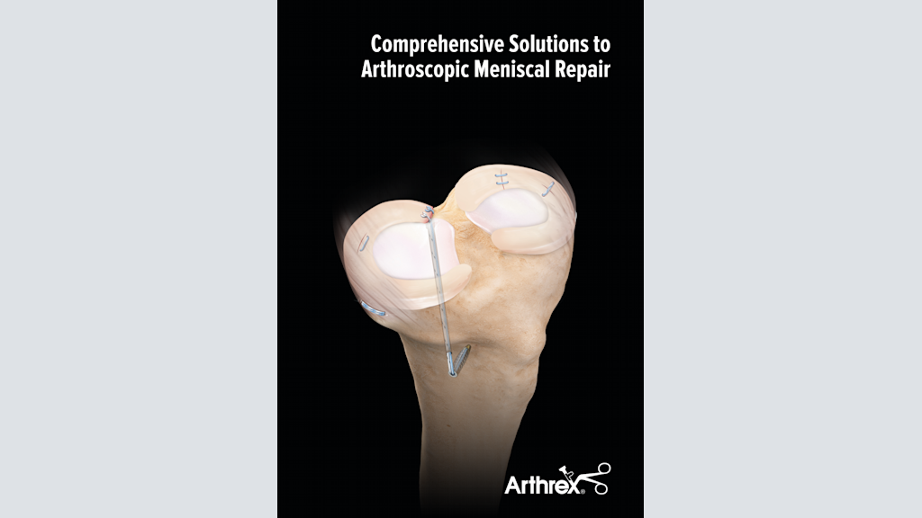 Comprehensive Solutions to Arthroscopic Meniscal Repair