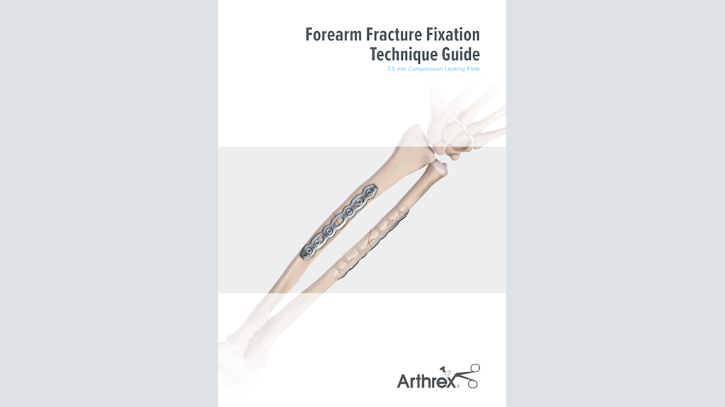 Forearm Fracture Fixation Technique Guide