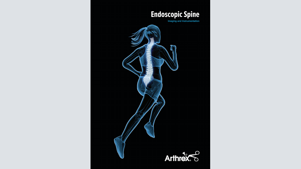 Endoscopic Spine