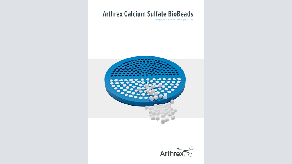 Arthrex Calcium Sulfate BioBeads - Mixing and Delivery Technique Guide