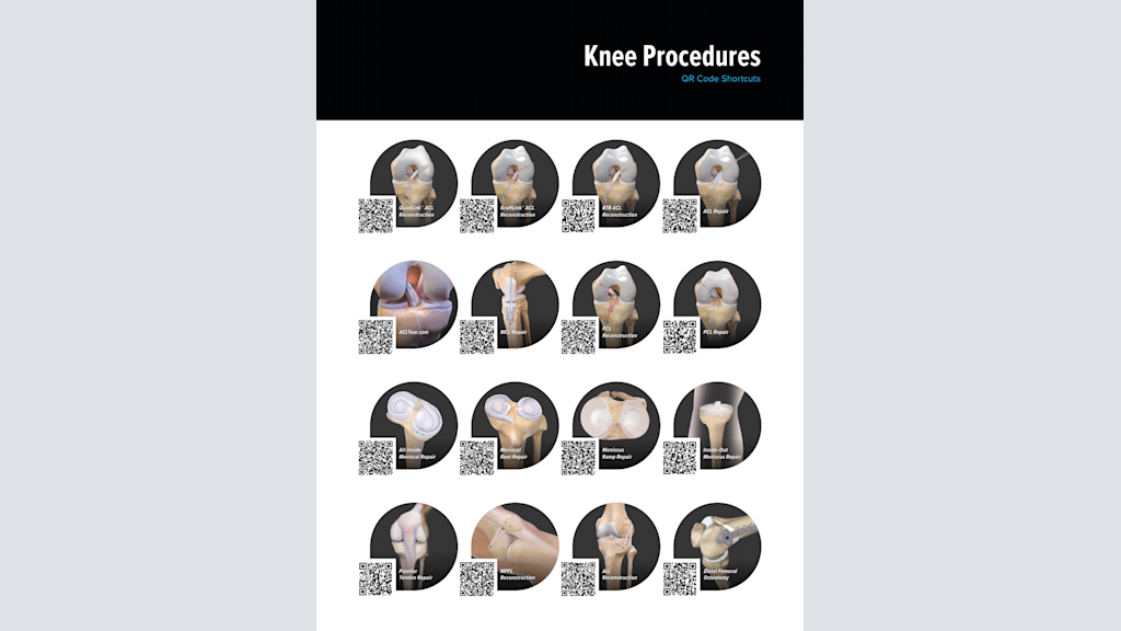 Knee Procedures QR Code Shortcuts