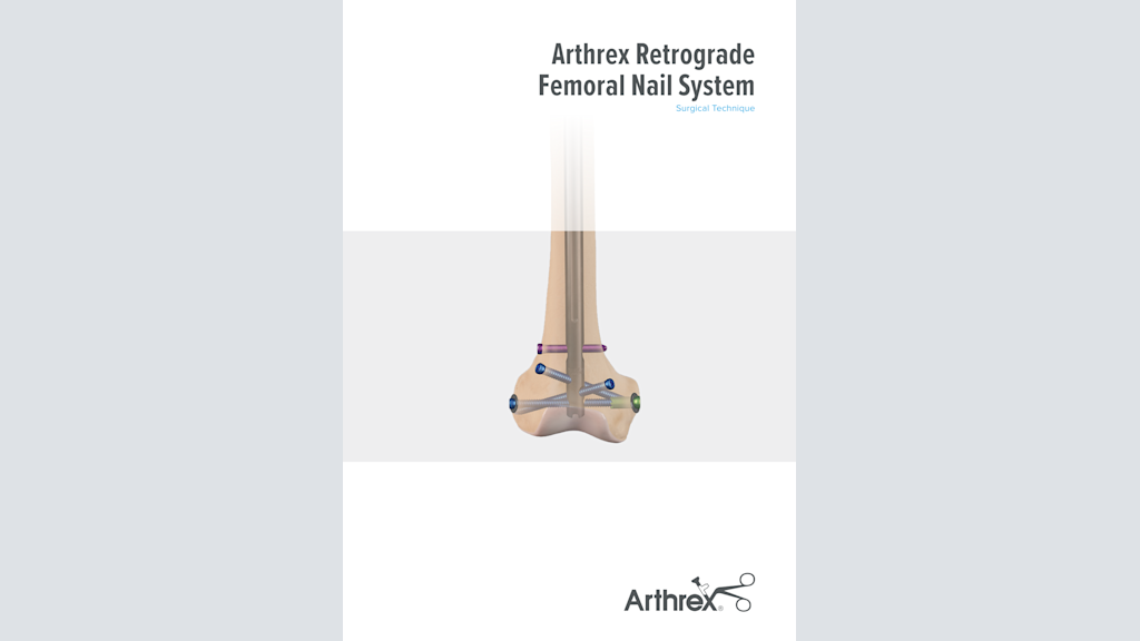 Arthrex Retrograde Femoral Nail System