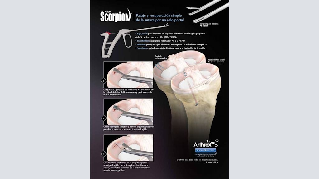 Knee Scorpion™ - Pasaje y recuperación simple de sutura por un solo portal