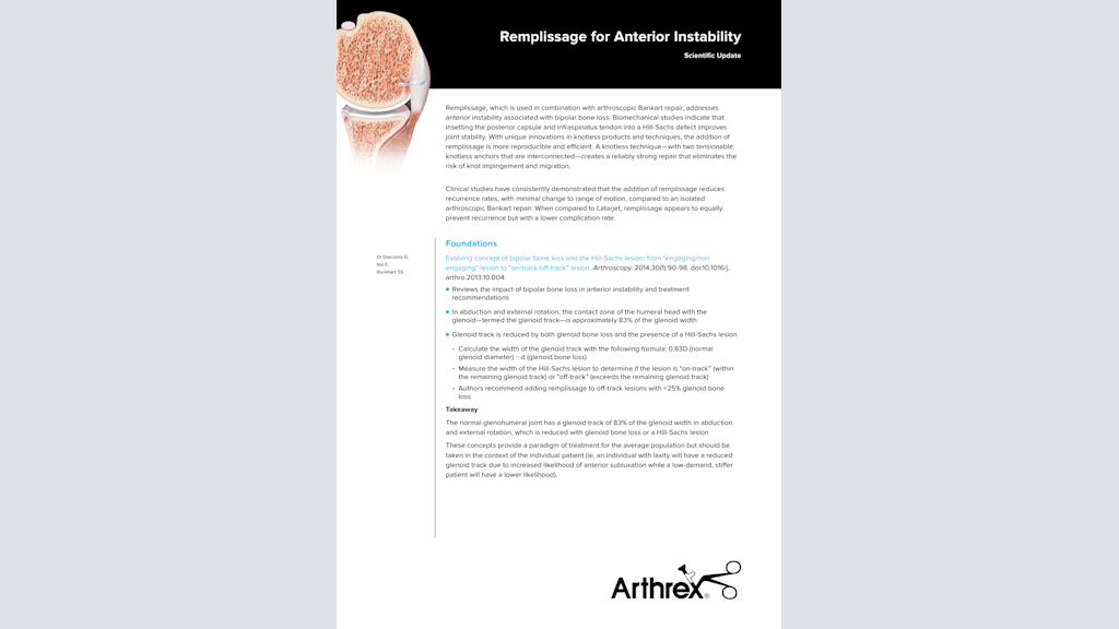 Remplissage for Anterior Instability Scientific Update