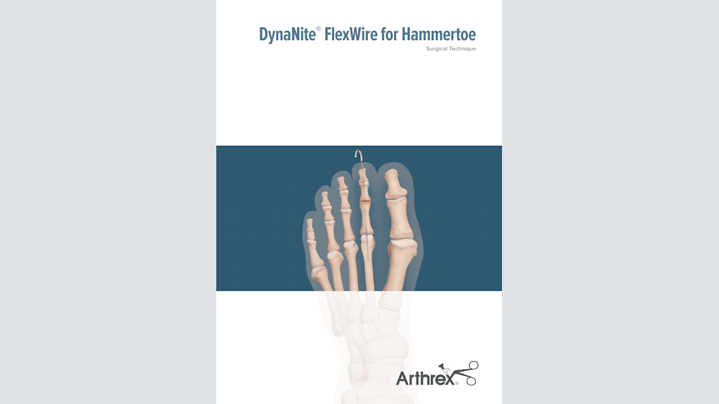 DynaNite® FlexWire for Hammertoe