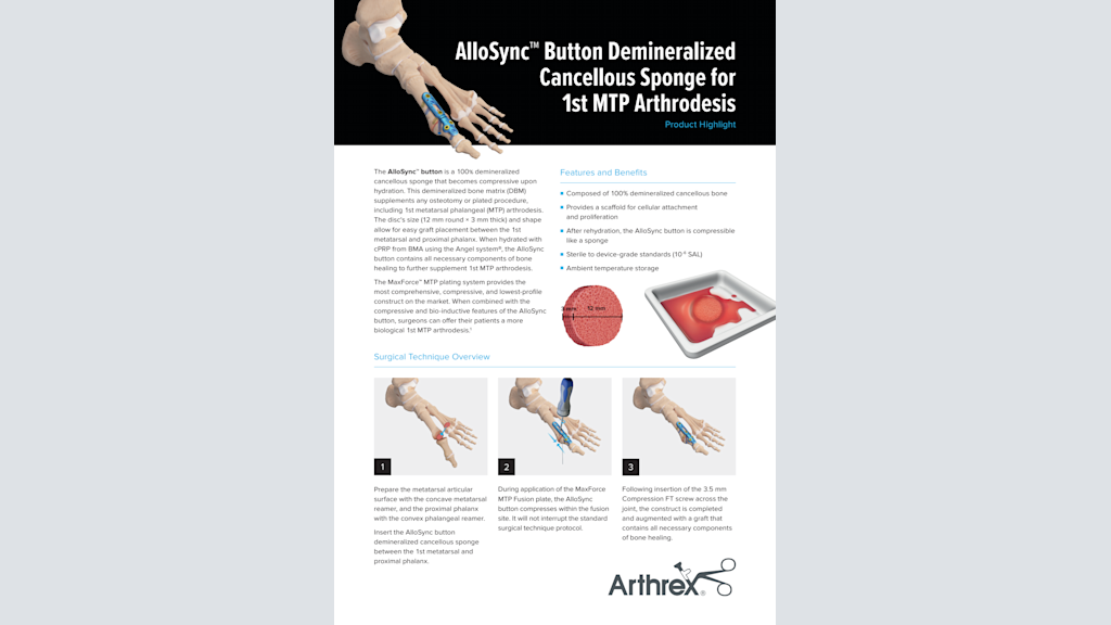 AlloSync™ Button Demineralized Cancellous Sponge for 1st MTP Arthrodesis