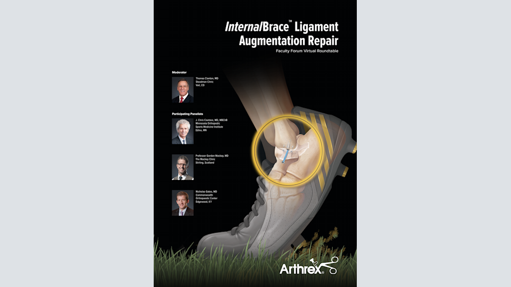 InternalBrace™ Ligament Augmentation Repair Faculty Forum Virtual Roundtable