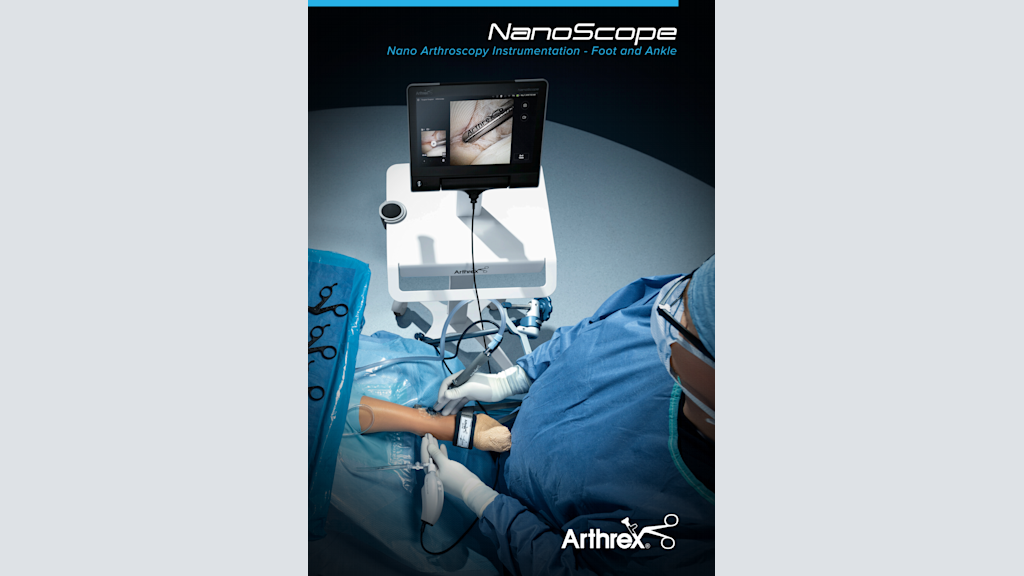 NanoScope™ Nano Arthroscopy Instrumentation - Foot and Ankle