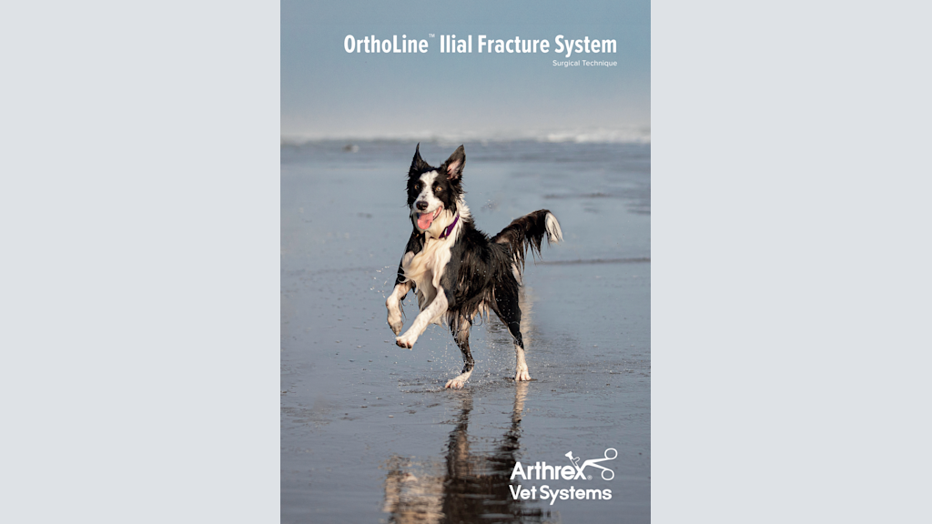 OrthoLine™ Ilial Fracture System