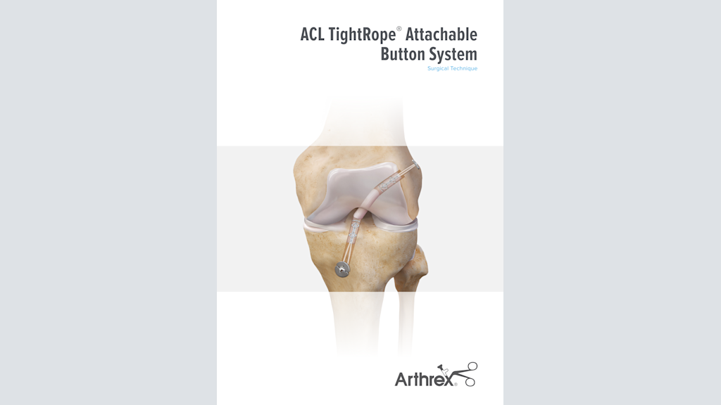 ACL TightRope® Attachable Button System