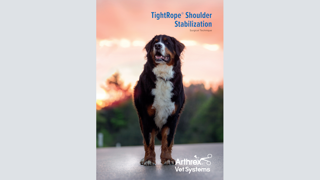 TightRope® Shoulder Stabilization