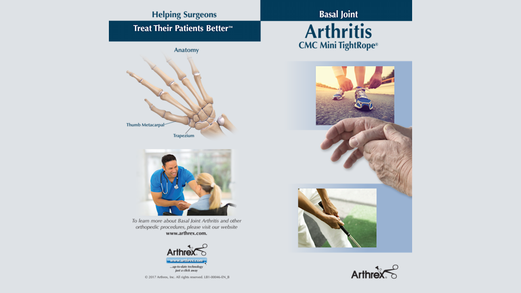 Basal Joint Arthritis - CMC Mini TightRope®