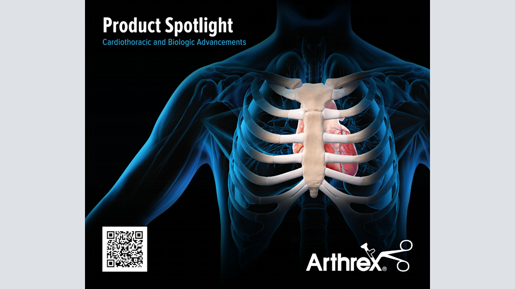 Product Spotlight Cardiothoracic and Biologic Advancements