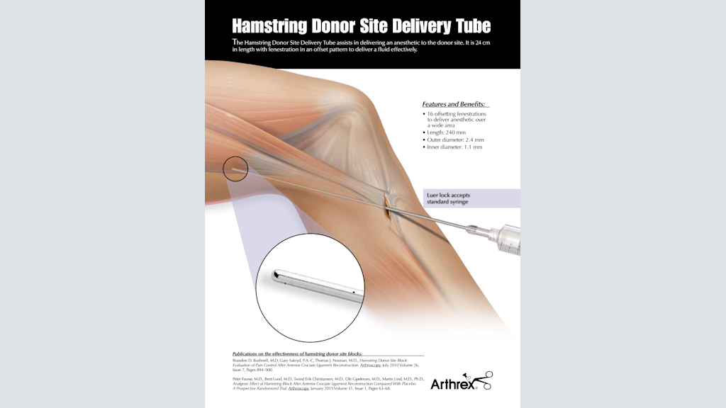 Hamstring Donor Site Delivery Tube