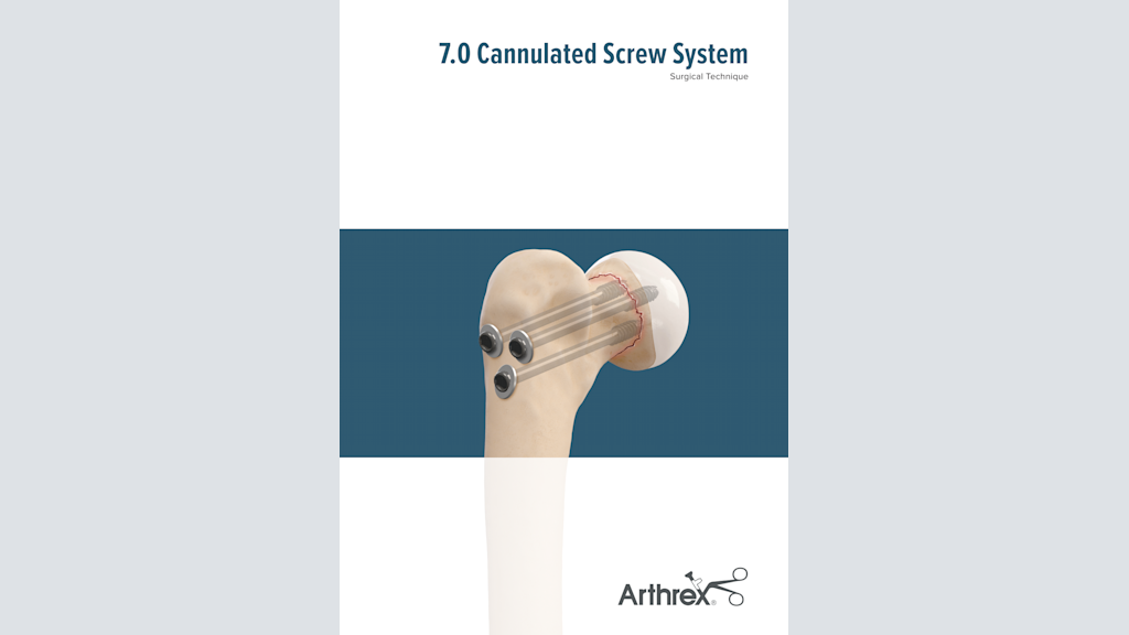 7.0 Cannulated Screw System