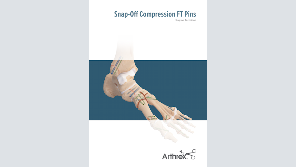 Snap-Off Compression FT Pins