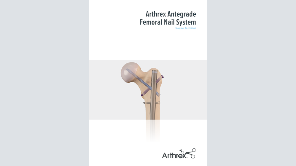 Arthrex Antegrade Femoral Nail System