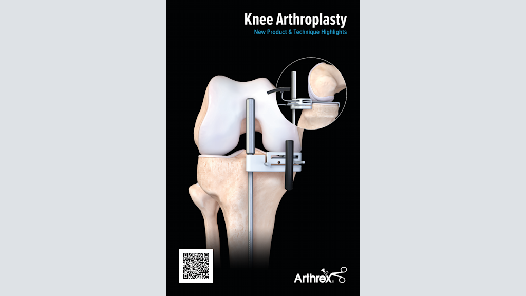 Knee Arthroplasty New Product & Technique Highlights
