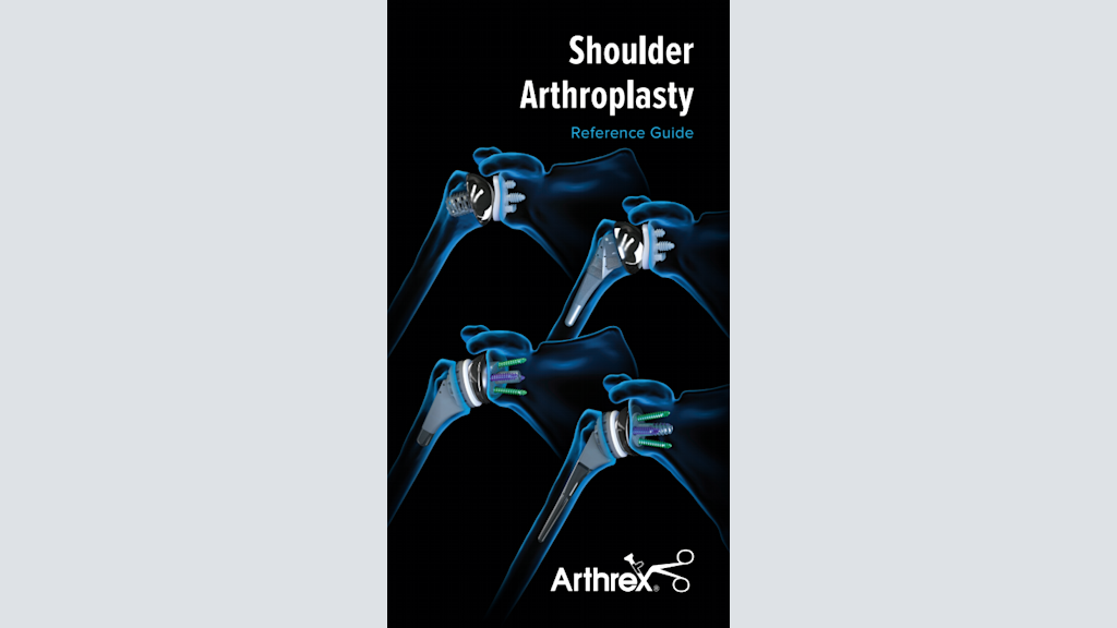 Shoulder Arthroplasty Reference Guide