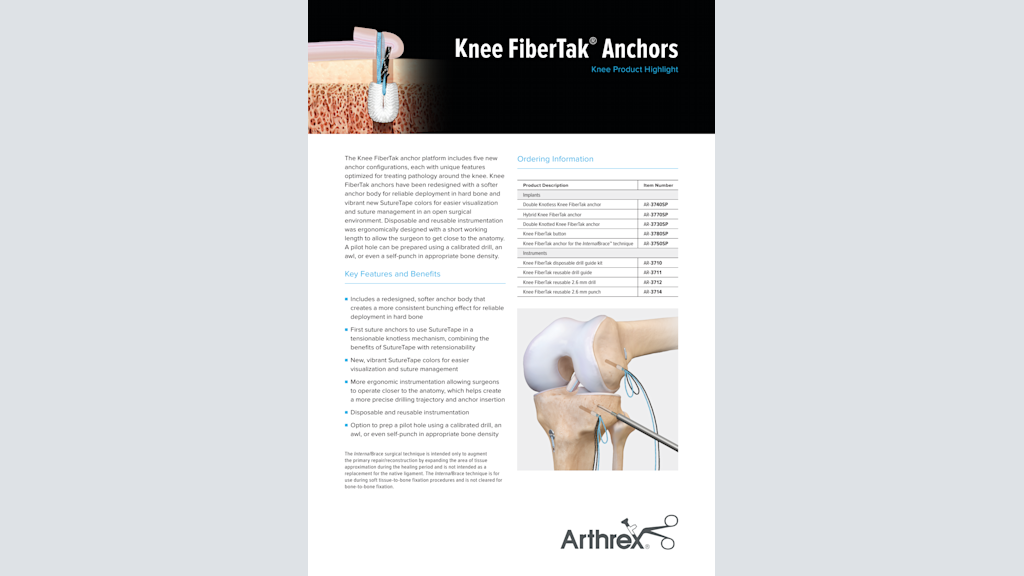 Knee FiberTak®  Anchors