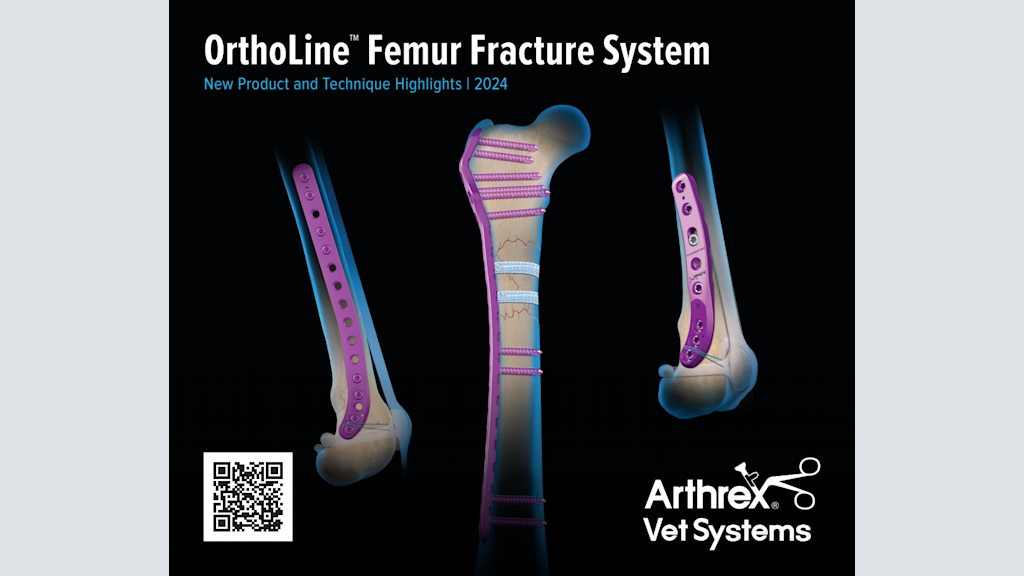 OrthoLine™  Femur Fracture System New Product and Technique Highlights 2024