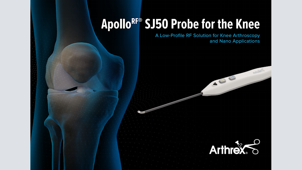 Apollo<sup>RF®</sup> SJ50 Probe for the Knee