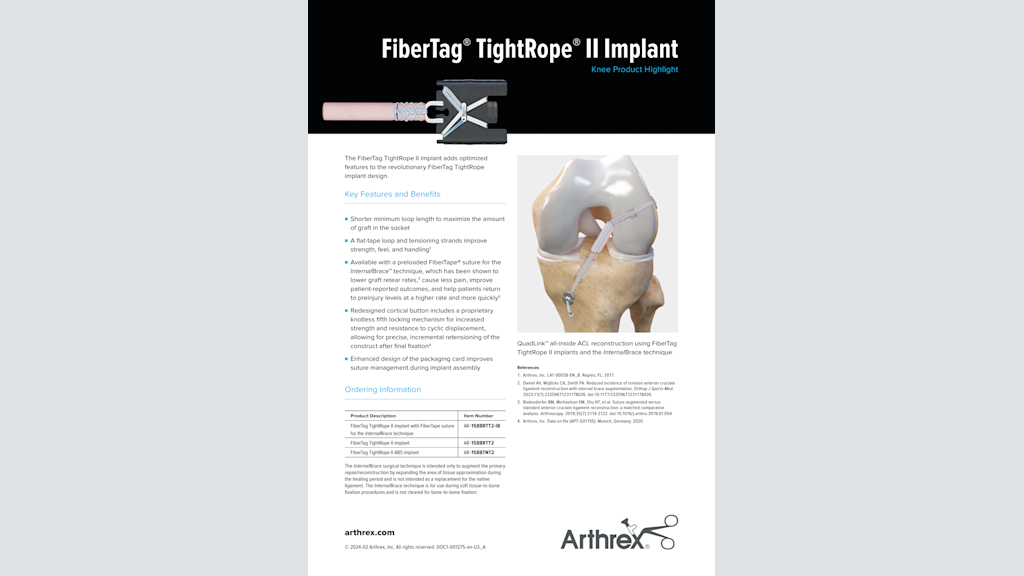 FiberTag® TightRope® II Implant