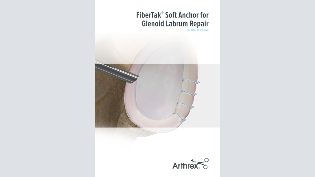 FiberTak® Soft Anchor for Glenoid Labrum Repair