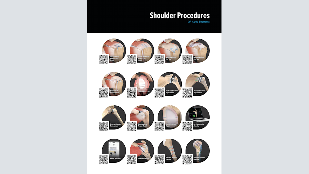 Shoulder Procedures QR Code Shortcuts