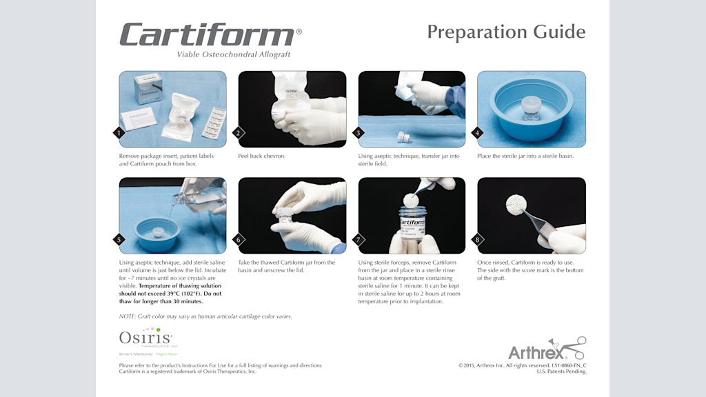 Cartiform® Viable Osteochondral Allograft Preparation Guide