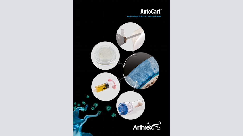 AutoCart™ Single-Stage Articular Cartilage Repair