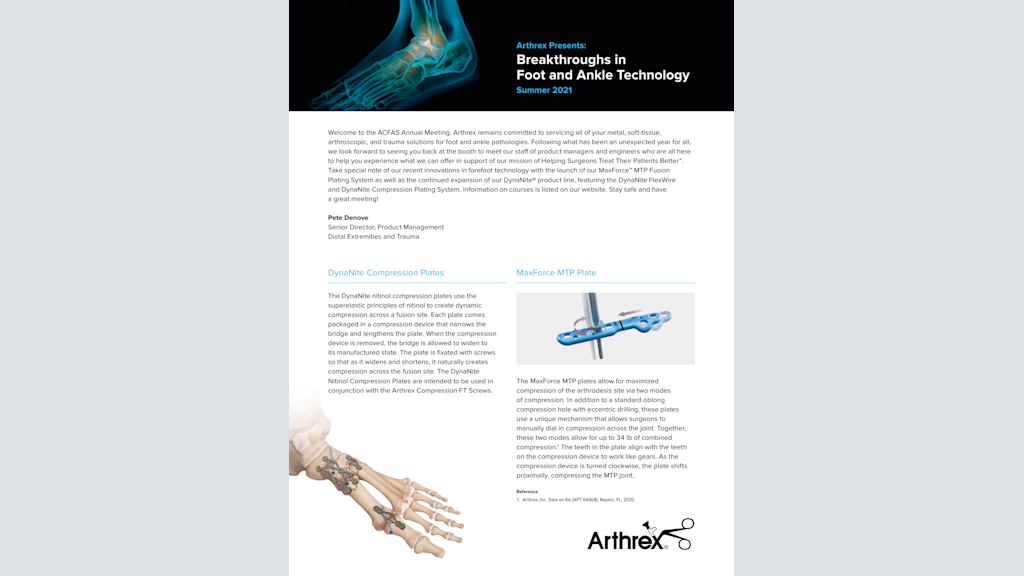 Arthrex Presents: Breakthroughs in Foot and Ankle Technology