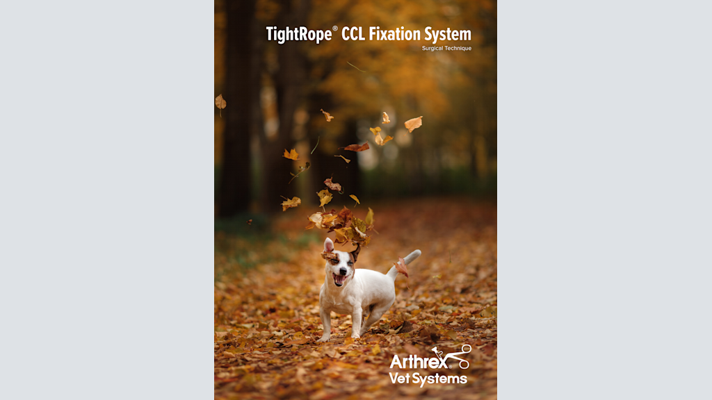 TightRope® CCL Fixation System