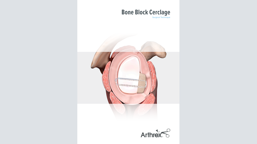 Bone Block Cerclage