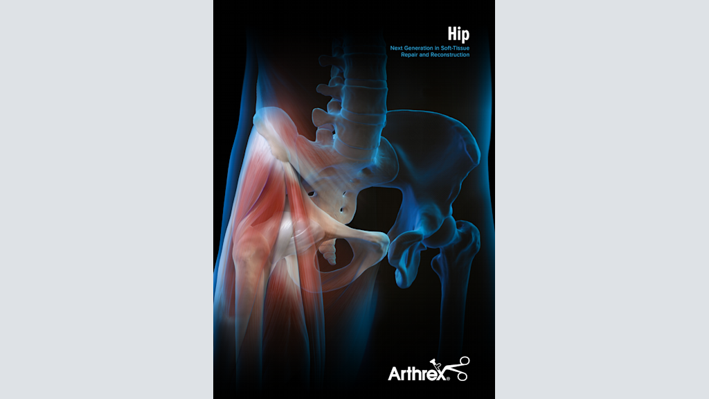 Hip Next Generation in Soft-Tissue Repair and Reconstruction