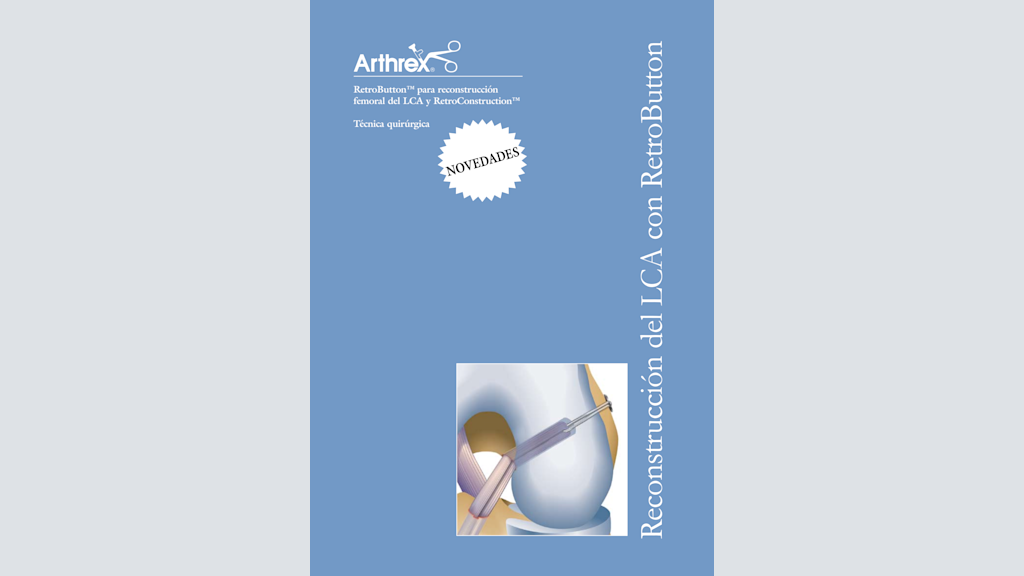 RetroButton® para reconstrucción femoral del LCA y RetroConstruction™