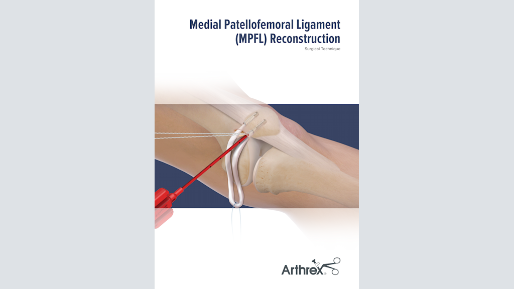 Medial Patellofemoral Ligament (MPFL) Reconstruction