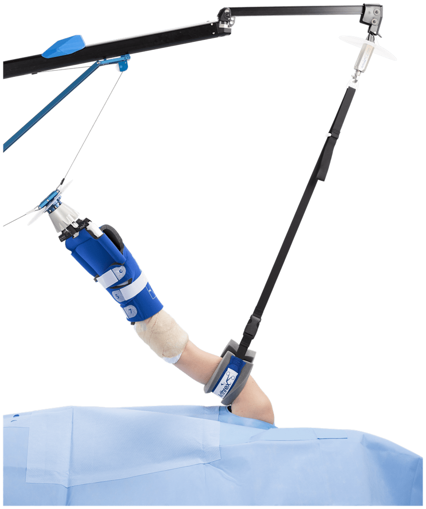 Arthrex - Shoulder Suspension System (S3) (Includes: Tower
