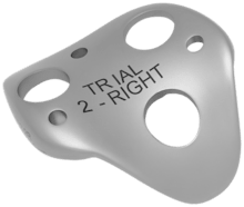 iBalance PFJ, Femoral Trial, Size 2- Right