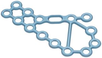 Calcaneal Fracture Plate, Perimeter, Large, Left