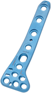 Posterolateral Distal Tibia Plate, Titanium, Left, 6 Hole