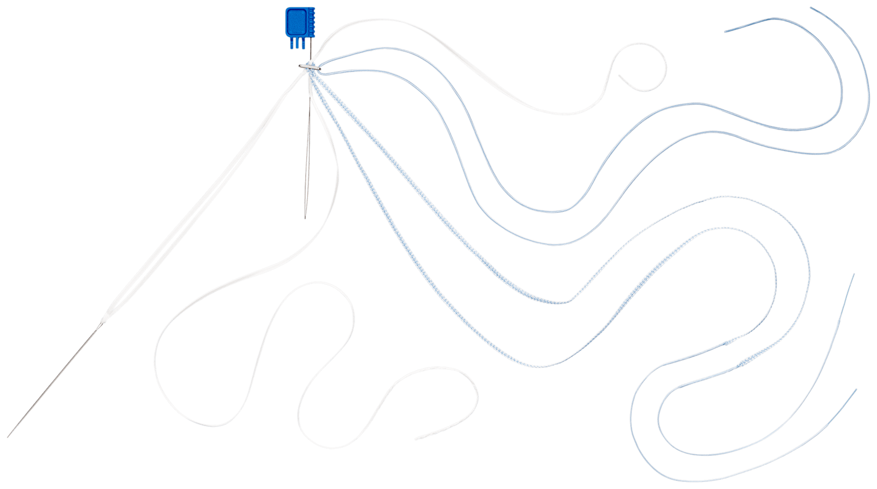 TightRope II-BTB, Rekonstruktion mit <i>Internal</i>Brace-Augmentations- Bandnaht