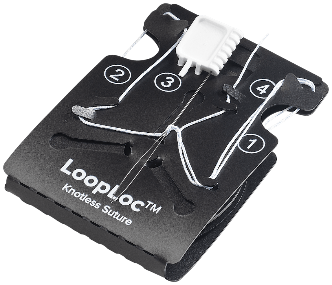 LoopLoc Knotless Implant
