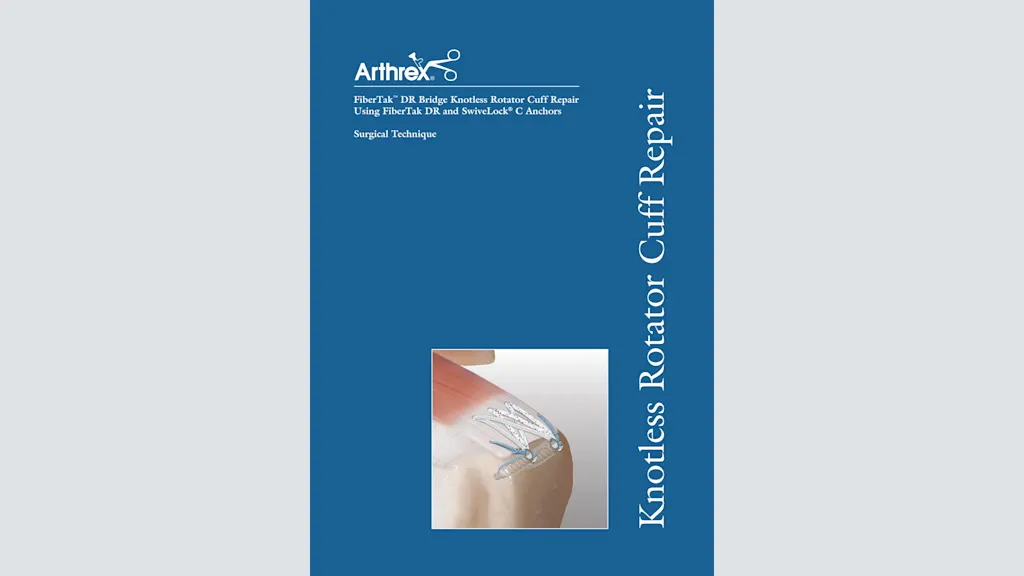 FiberTak™ DR Bridge Knotless Rotator Cuff Repair Using FiberTak DR and SwiveLock® C Anchors