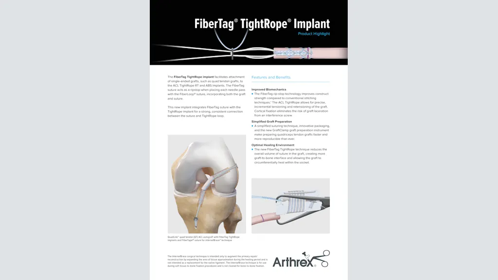 FiberTag® TightRope® Implant