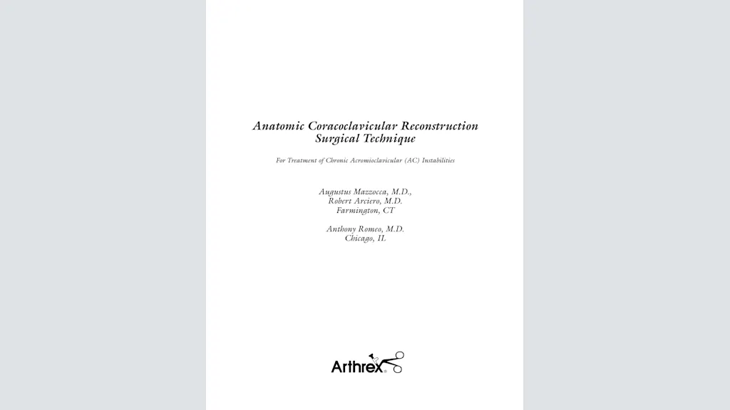 Anatomic Coracoclavicular Reconstruction - For Treatment of Chronic Acromioclavicular (AC) Instabilities